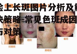 一、认识脸上长斑的类型